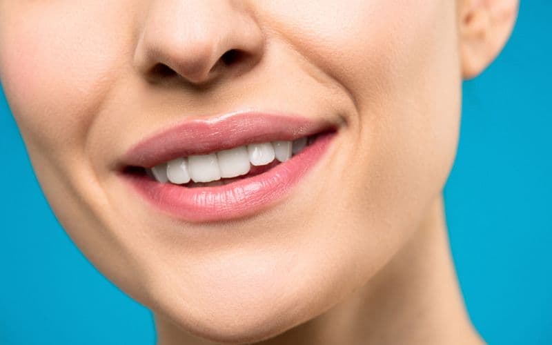 Invisalign Clear Aligners — before treatment