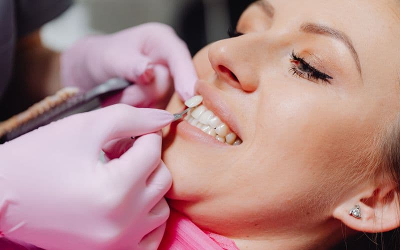Ceramic Veneer Placement — before treatment
