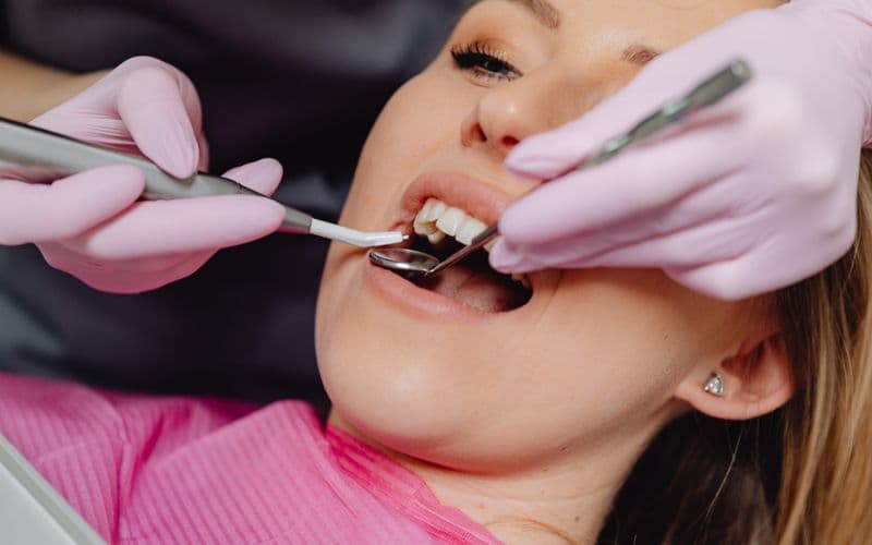 Teeth Bonding & Contouring — before treatment
