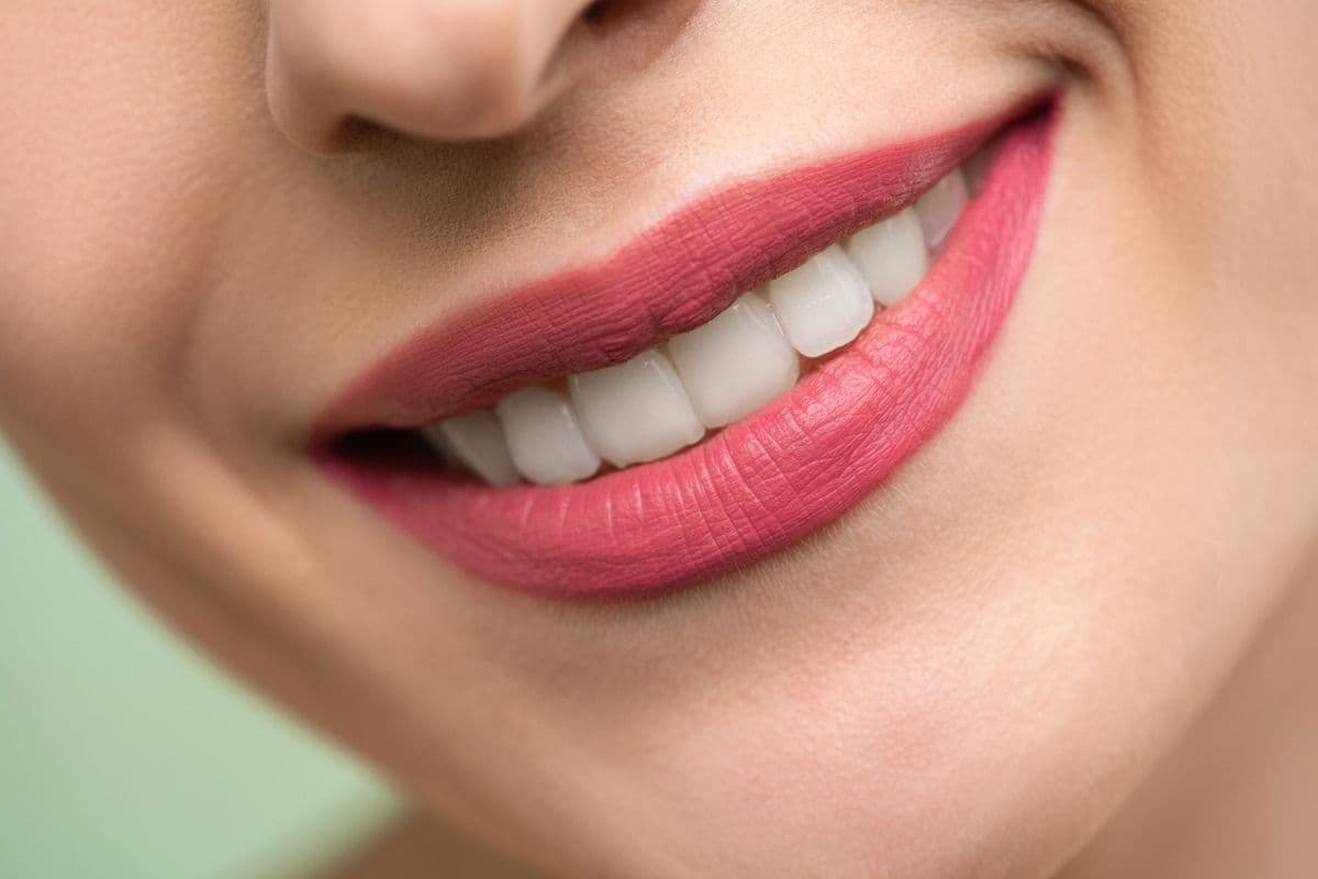 Radiant white smile close up after cosmetic treatment